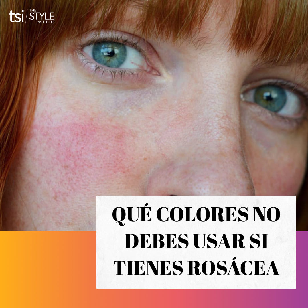 QUE COLORES NO USAR SI TIENES ROSÁCEA